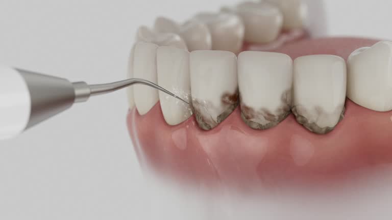 Trusted Root Canal Treatment service in Marshfield Hills, MA - Dentist Open Now